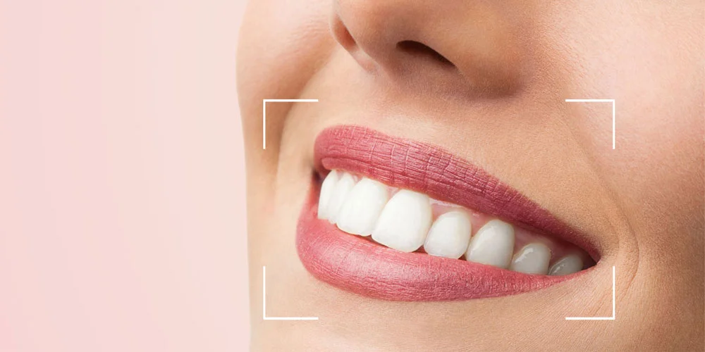 Smile Designing treatment at Hadi Perfect Smile Dental Clinic for a perfect smile.