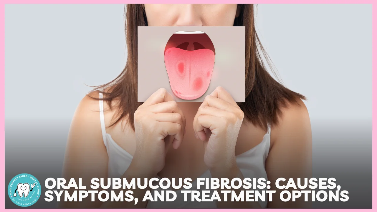 Oral Submucous Fibrosis: Causes, Symptoms, and Treatment | Hadi Perfect Smile - Dental Clinic