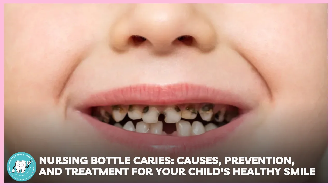 Toddler with bottle and early tooth decay—nursing bottle caries explained by Hadi Perfect Smile Dental Clinic.
