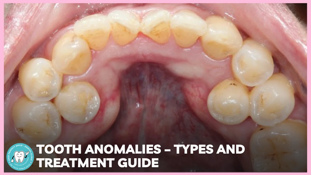 Illustration showing different types of tooth anomalies such as missing, extra, and irregularly shaped teeth.
