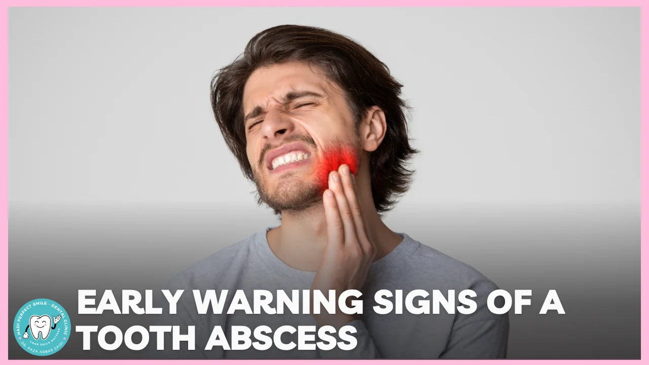 Illustration showing a tooth abscess with swelling and infection around the tooth root.